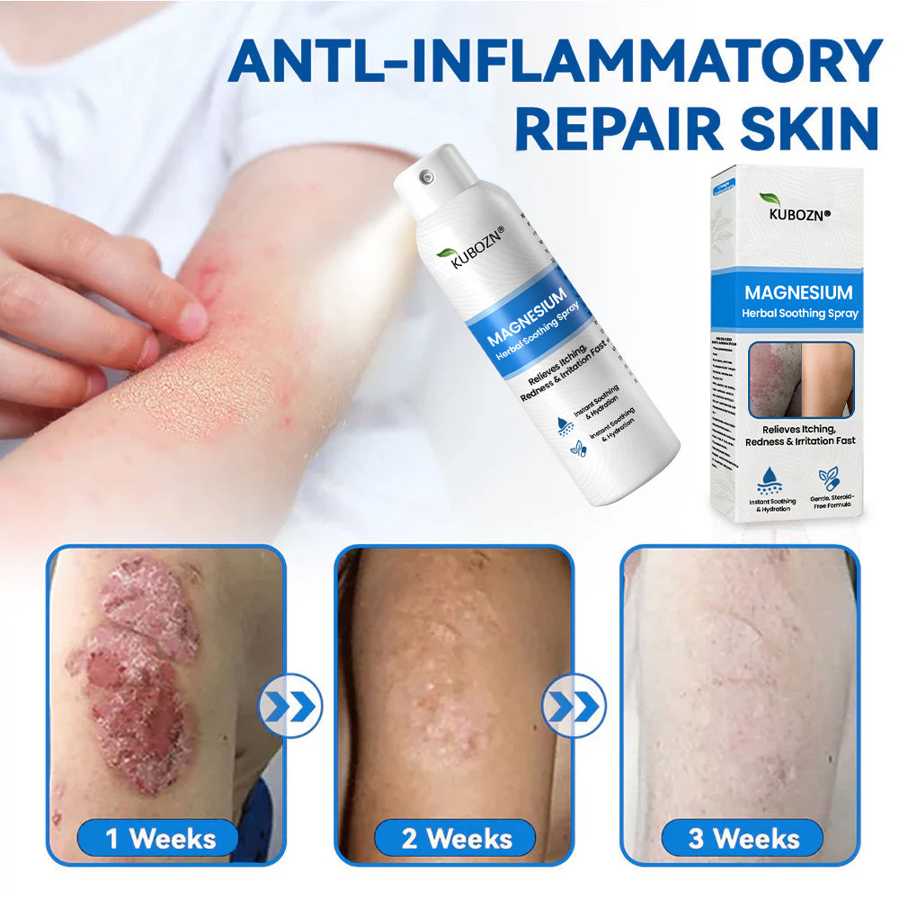 FDA Certified⚕️ KUBOZN® Magnesium Herbal Psoriasis Spray ⚡3-MINUTE RELIEF