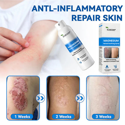 FDA Certified⚕️ KUBOZN® Magnesium Herbal Psoriasis Spray ⚡3-MINUTE RELIEF