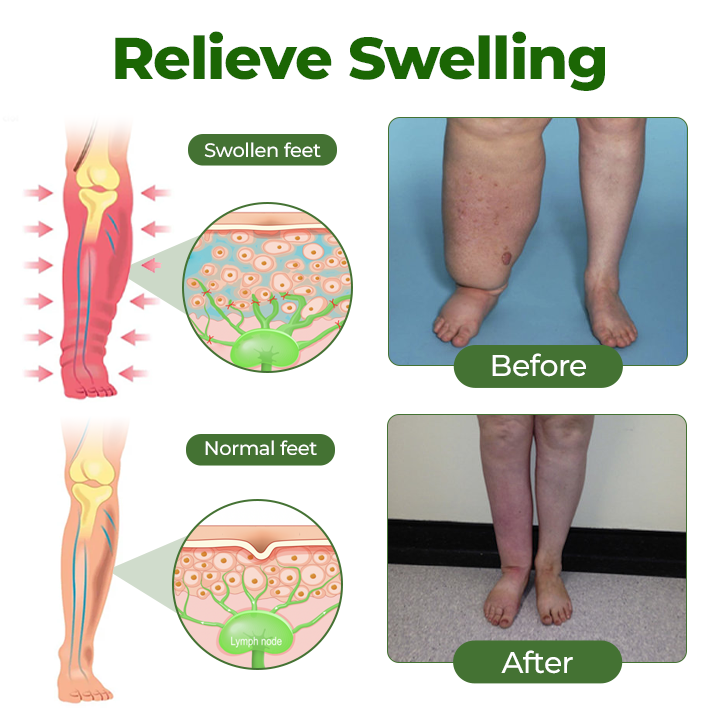 Healrize® Professional Leg Circulation Cream