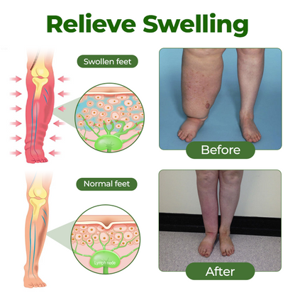 Healrize® Professional Leg Circulation Cream