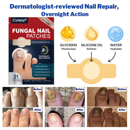 Cvreoz® - Fungal Nail Patches 🌿