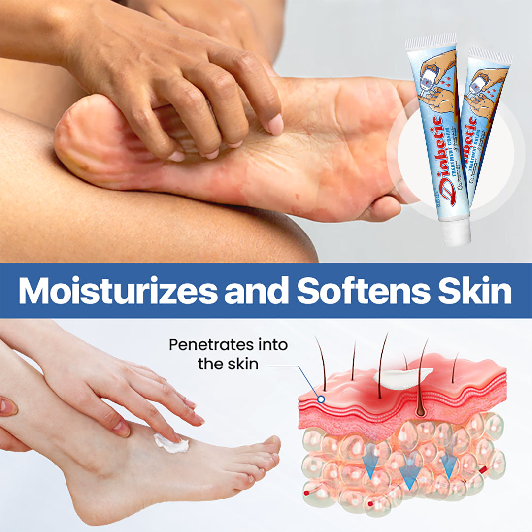 KUBOZN® VitaGluco Diabetes Treatment Cream✅ Heal Diabetic Wounds Faster & Safer