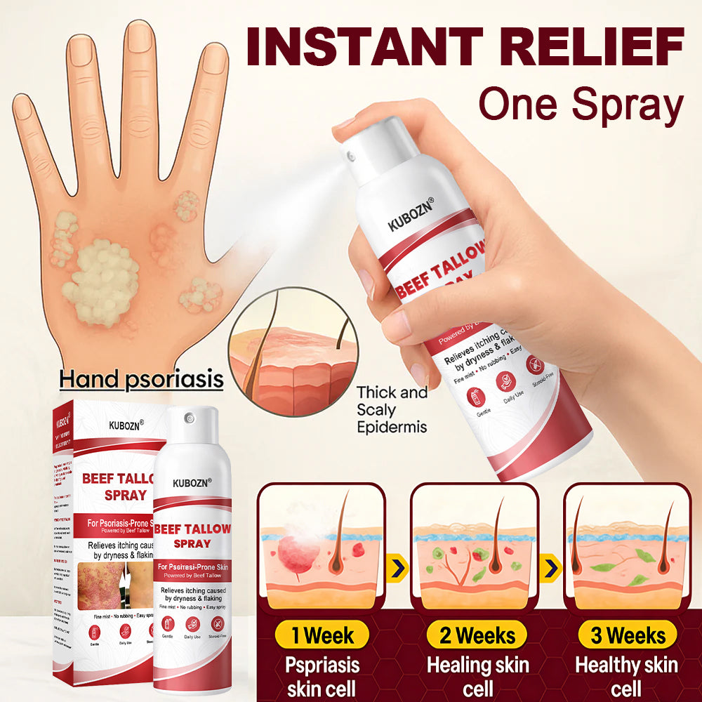 KUBOZN® Beef Tallow Spray — The No-Rub Relief for Psoriasis-Prone Skin✨
