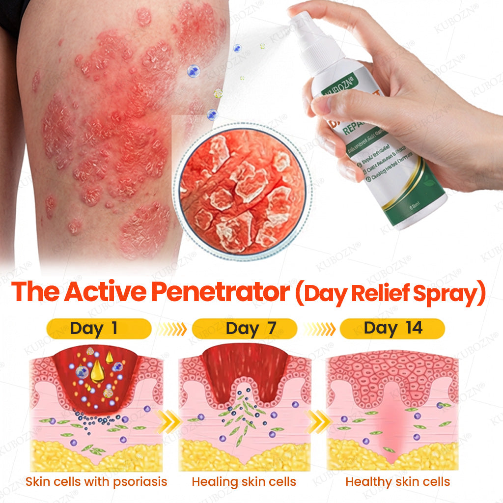 KUBOZN® Psoriasis Day & Night Repair System - 100% Steroid-Free Relief Duo for Plaques, Scaling & Itch