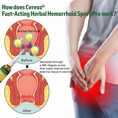 Cvreoz® Fast-Acting Herbal Hemorrhoid Spray Pro offer
