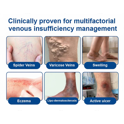 🔥🔥Healrize® Micro-Mist Herbal Varicose Veins Spray ✨ Pain-Free & Deep Repair