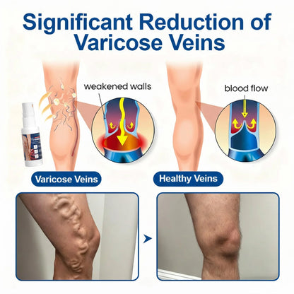 🔥🔥Healrize® Micro-Mist Herbal Varicose Veins Spray ✨ Pain-Free & Deep Repair