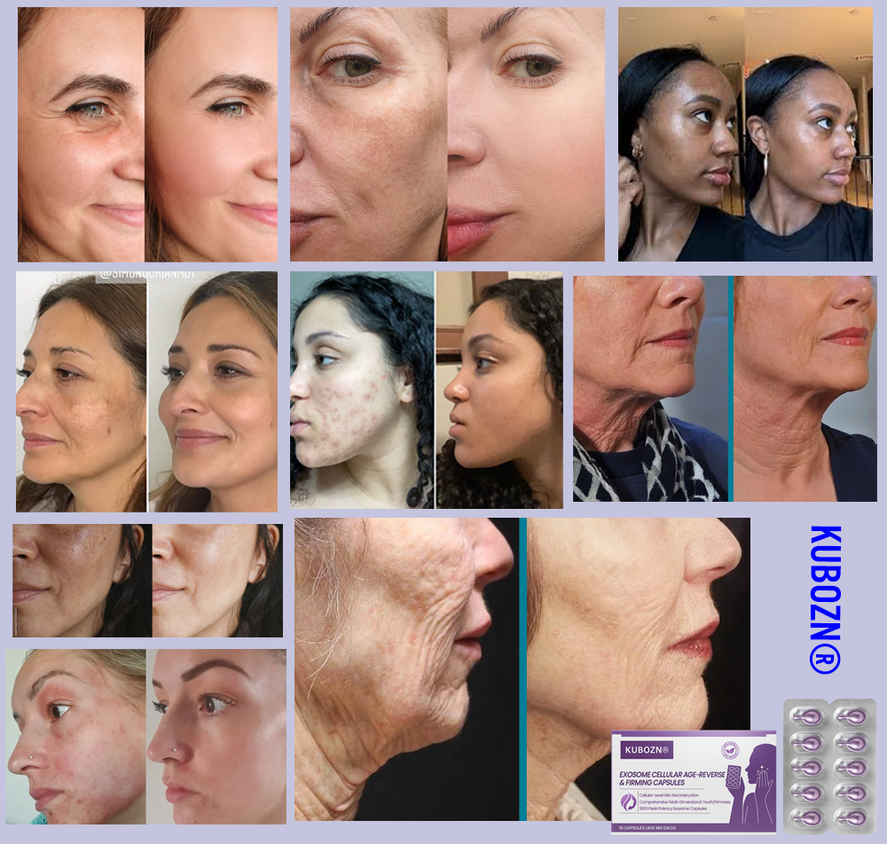 KUBOZN® Exosome Cellular Age-Reverse & Firming Capsules