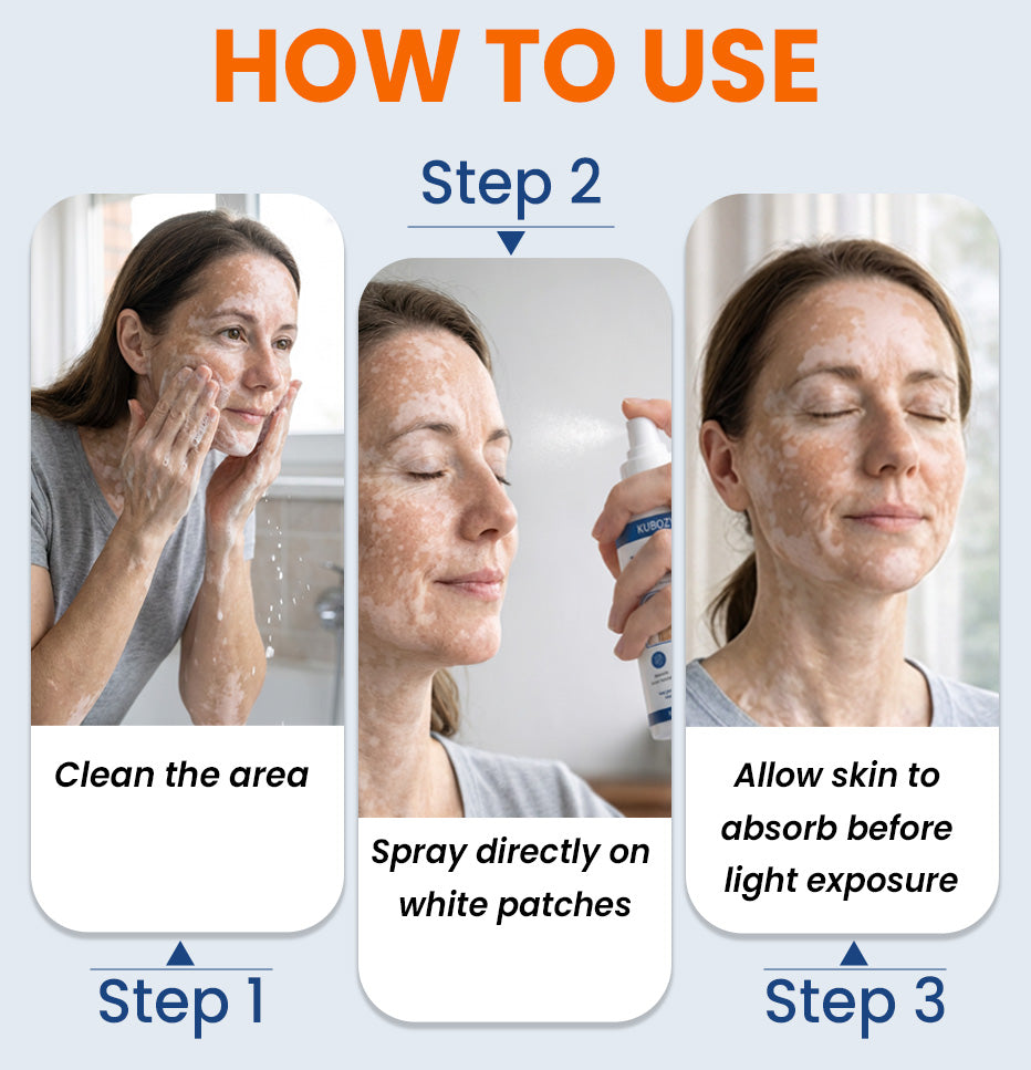 ⚡KUBOZN® Piperine Repigment Activator Spray to Reactivate Dormant Pigment Cells & Restore Natural Skin Color