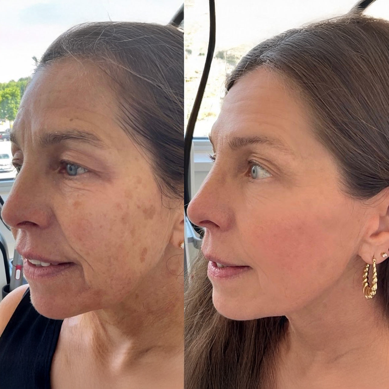 KUBOZN® Exosome Cellular Age-Reverse & Firming Capsules