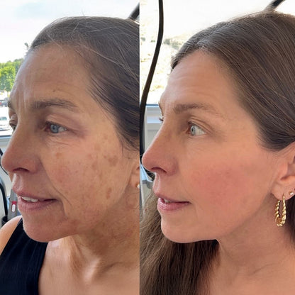 KUBOZN® Exosome Cellular Age-Reverse & Firming Capsules