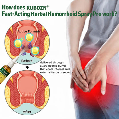 KUBOZN® Fast-Acting Herbal Hemorrhoid Spray Pro