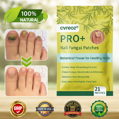 🍃Cvreoz® Nail Fungal Patches Pro+